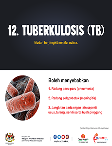 Tuberkulosis(TB) - infografik 12